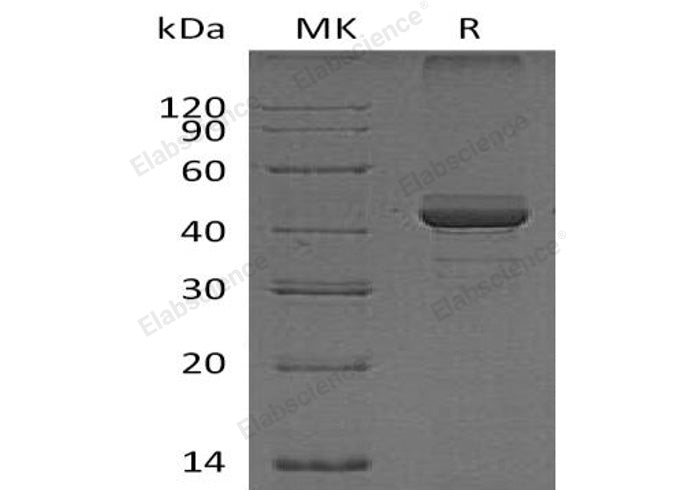 Recombinant Human FIBP Protein