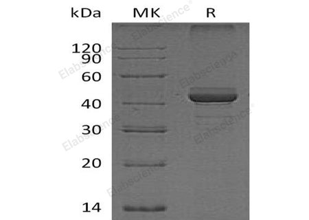 Recombinant Human FIBP Protein