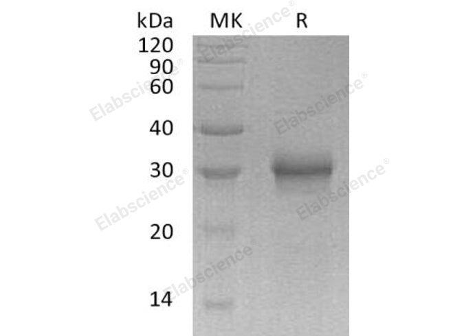 Recombinant Human FGF-17 Protein (His Tag)(Active)