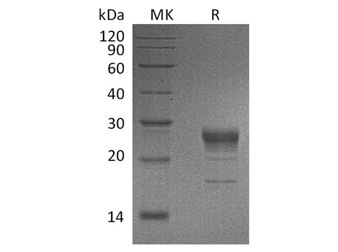 Recombinant Human FGF-7/KGF Protein (His Tag)(Active)