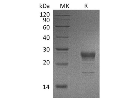 Recombinant Human FGF-7/KGF Protein (His Tag)(Active)