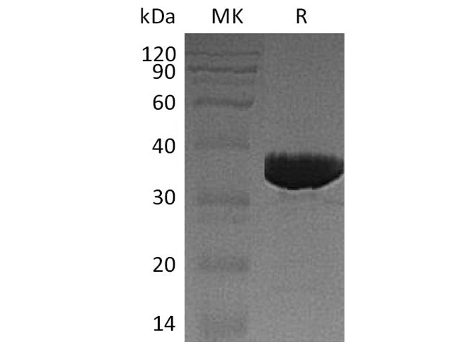 Recombinant Human GALM Protein (His Tag)
