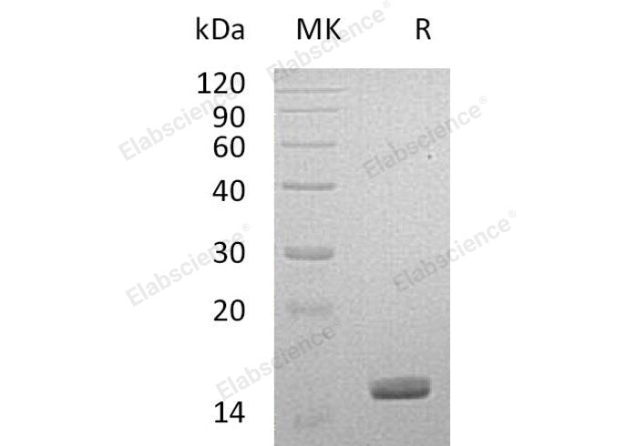 Recombinant Human Galectin-14/LGALS14 Protein (His Tag)