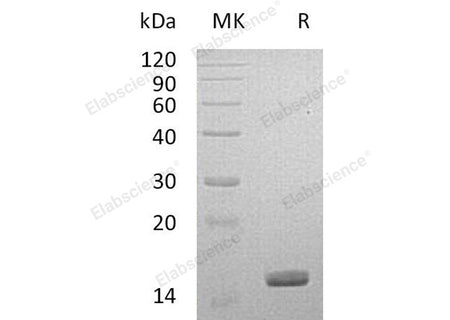 Recombinant Human Galectin-14/LGALS14 Protein (His Tag)