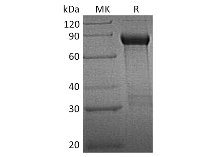 Recombinant Human GFRA1/GDNFRA Protein (Fc Tag)