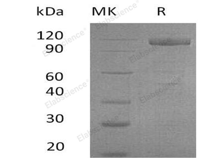 Recombinant Human GFRRA2 Protein ((Fc & His Tag)