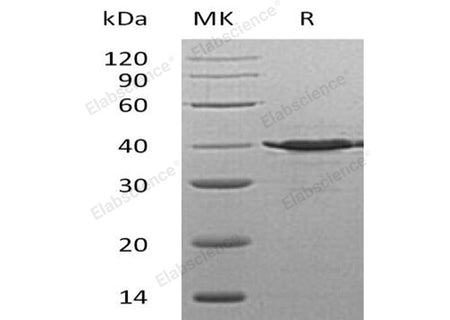 Recombinant Human TSTA3/SDR4E1 Protein (His Tag)