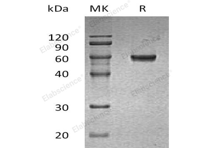 Recombinant Human GLUL Protein (His Tag)