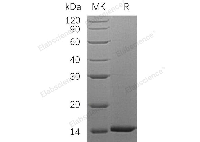 Recombinant Human HDGF Protein (His Tag)