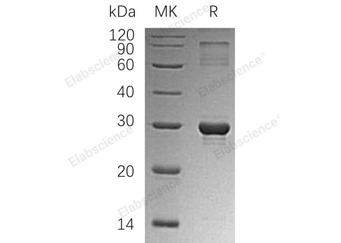Recombinant Human HGPRT/HPRT1 Protein (His Tag)