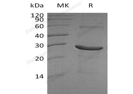 Recombinant Human IA2/PTPRN Protein (aa 607-Asn686 & aa 795-888, His Tag)