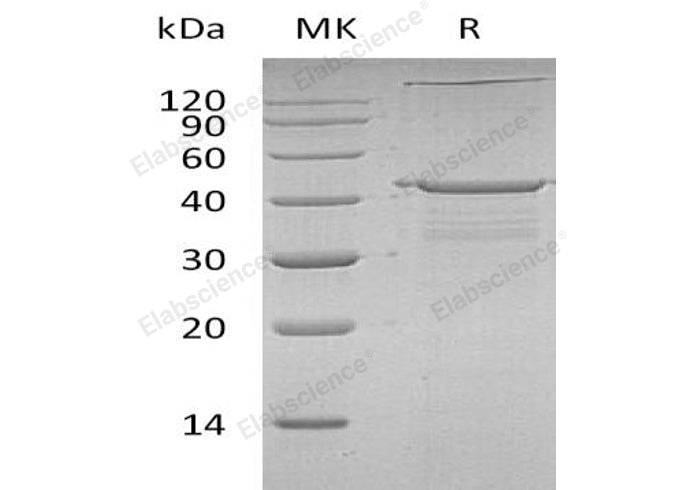 Recombinant Human IGF2BP2 Protein (His Tag, N-T7 Tag)
