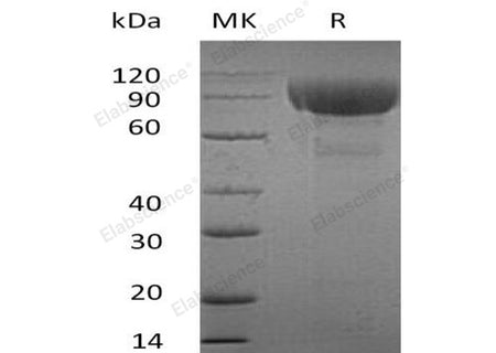 Recombinant Human IL-1RL2 Protein (Fc Tag)(Active)