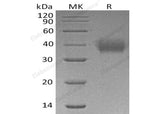 Recombinant Human CD89/FCAR Protein (His Tag)