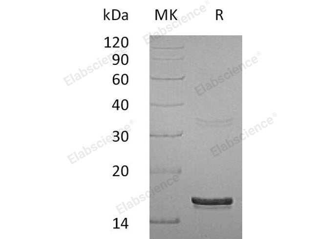 Recombinant Human Interferon γ/IFNG Protein