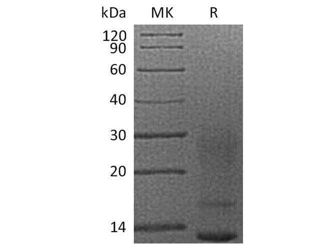 Recombinant Human Interleukin-13/IL-13 Protein (His Tag)(Active)