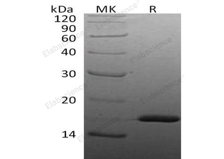 Recombinant Human IL-1 beta/IL1B Protein