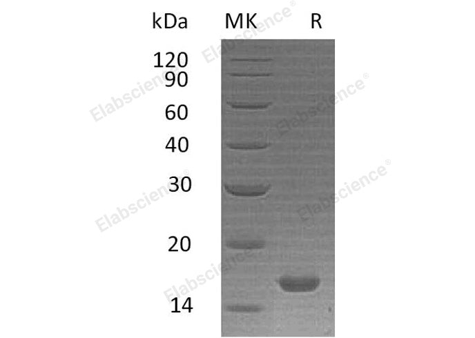 Recombinant Human Interleukin-21/IL-21 Protein (Active)