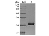 Recombinant Human IFN-λ3/IL-28B Protein (Human Cells, His Tag)(Active)