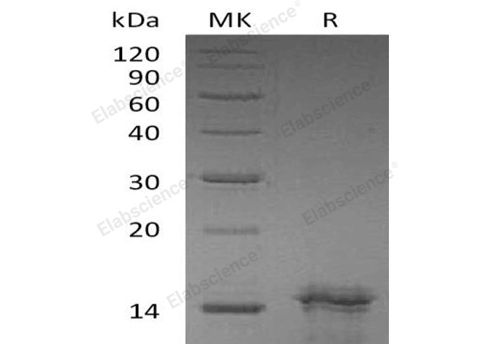Recombinant Human Interleukin-31/IL-31 Protein