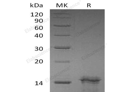 Recombinant Human Interleukin-31/IL-31 Protein
