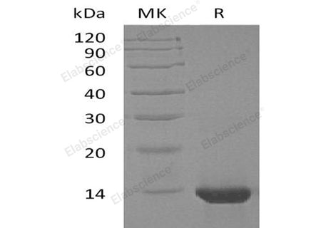 Recombinant Human Interleukin-4/IL-4 Protein (Active)