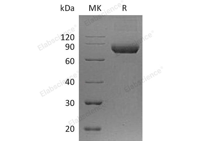 Recombinant Human IL5RA/IL-5 Rα Protein (Fc Tag) 