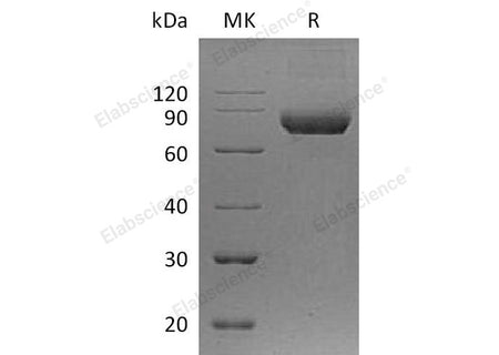 Recombinant Human IL5RA/IL-5 Rα Protein (Fc Tag) 