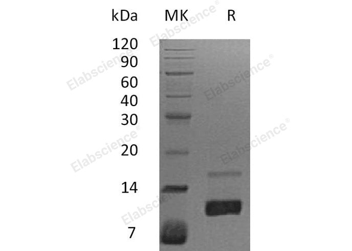 Recombinant Human IL-8/CXCL8 Protein (aa 28-99) 
