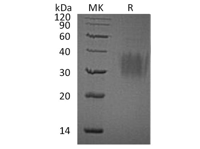 Recombinant Human Interleukin-9/IL-9 Protein (His Tag)