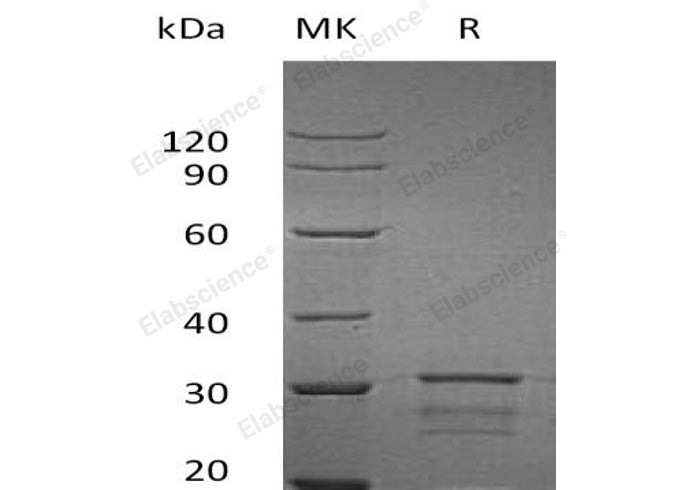 Recombinant Human IPPI2/IDI2 Protein (His Tag)