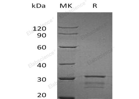 Recombinant Human IPPI2/IDI2 Protein (His Tag)