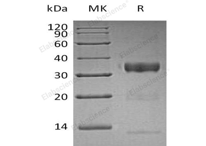 Recombinant Human Kallikrein 10/KLK10 Protein (His Tag)