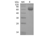 Recombinant Human KLRB1/CD161 Protein (Fc Tag)