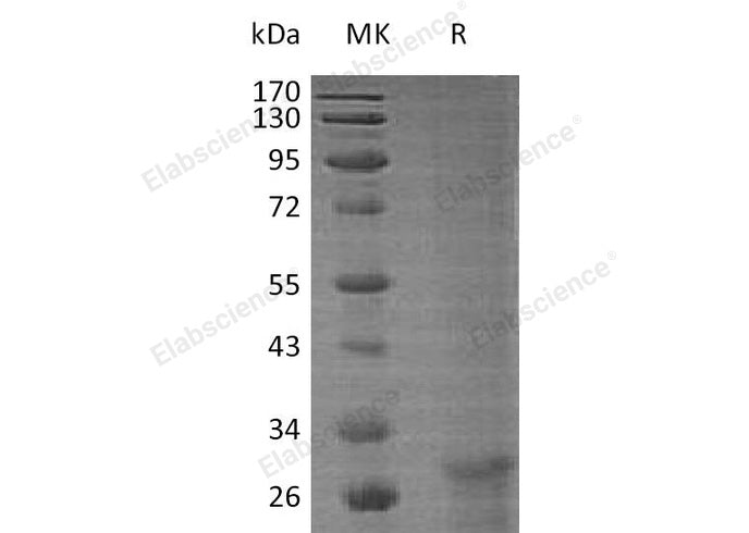 Recombinant Human KLF6 Protein