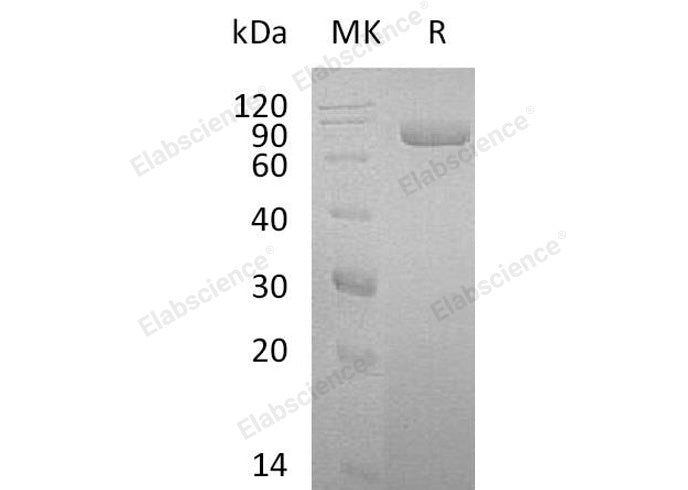 Recombinant Human Lactotransferrin/LTF Protein (His Tag)