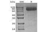 Recombinant Human LAMP2/CD107b Protein (His Tag)(Active)
