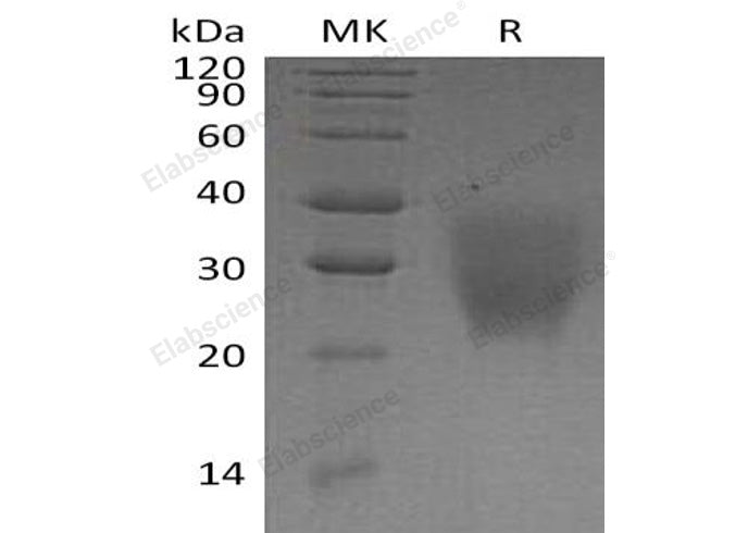 Recombinant Human LRRC25 Protein (His Tag)