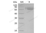 Recombinant Human LILRA2/ILT1 Protein (His Tag)