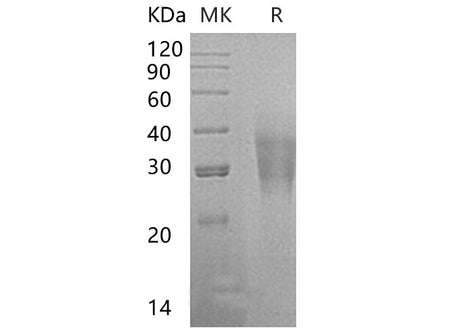 Recombinant Human CD300a/LMIR1 Protein (His Tag)