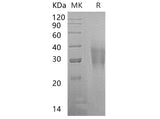 Recombinant Human CD300a/LMIR1 Protein (His Tag)
