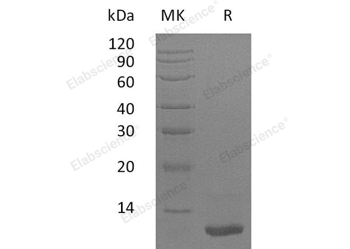 Recombinant Human LR3-IGF-1 Protein (MG)(Active)
