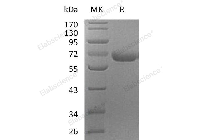 Recombinant Human PRCP Protein (His Tag)