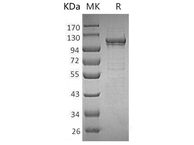 Recombinant Human MANSC1 Protein (His Tag)