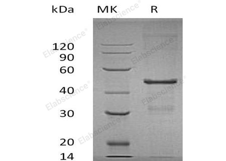 Recombinant Human MBIP Protein (His Tag)