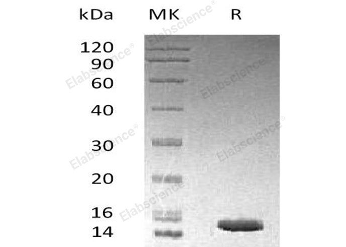 Recombinant Human LAMTOR3/MP1 Protein (His Tag)