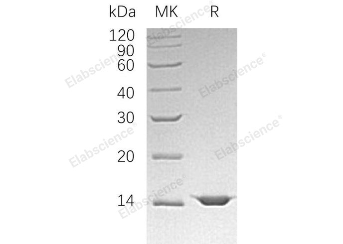 Recombinant Human Mitochondrial Fission 1 Protein/FIS1 Protein (His Tag)
