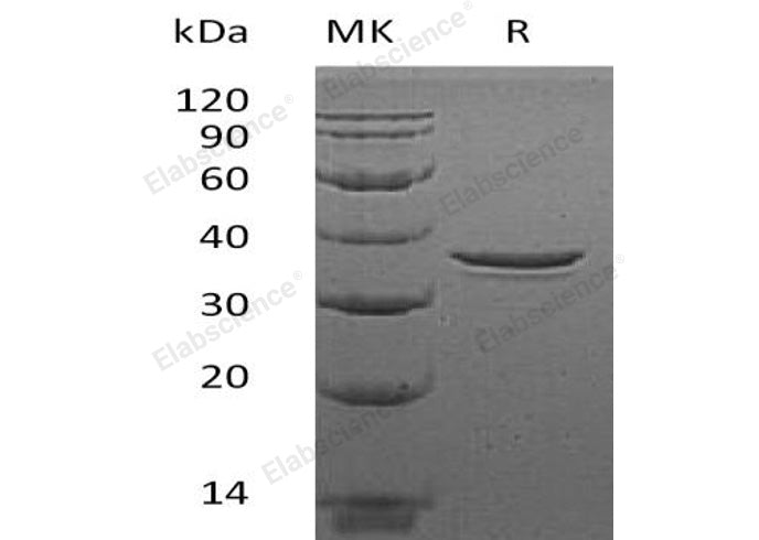 Recombinant Human MORF4L2/MRGX Protein (His Tag)