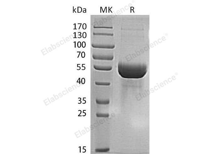 Recombinant Human MINPP1 Protein (His Tag)