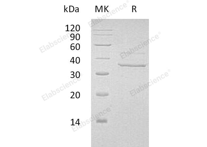Recombinant Human Myozenin-2/MYOZ2 Protein (His Tag)